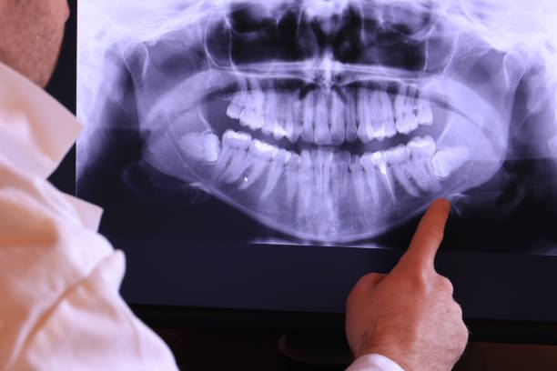 Best Cosmetic Emergency Dentistry in Tecumseh, MI