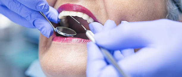 Best Emergency Gum Treatment in Tecumseh, MI